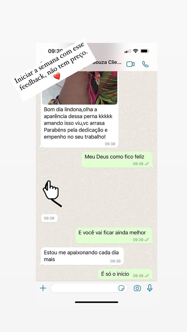 Cliente elogia aparência da perna e parabeniza dedicação da equipe